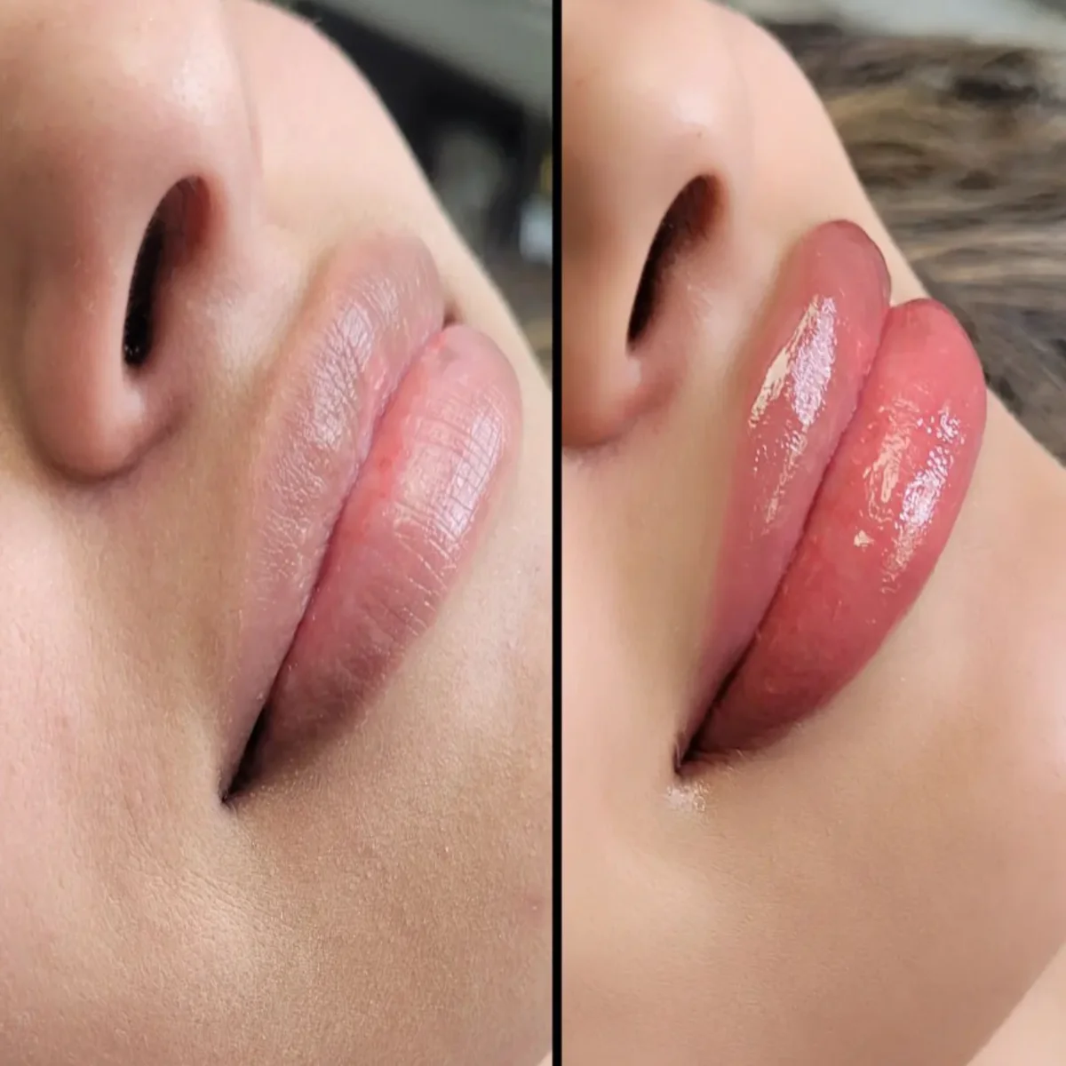 Cosmetic Tattooing Lips