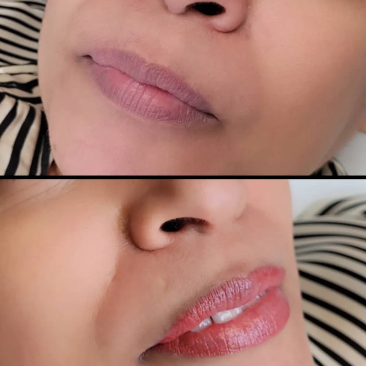 Tattooing Lips Cosmetic
