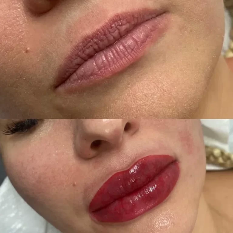Cosmetic lip tattoo