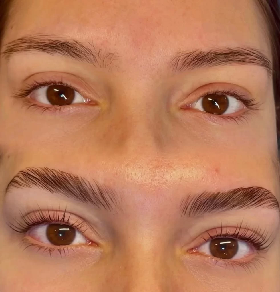 best method for oily skin