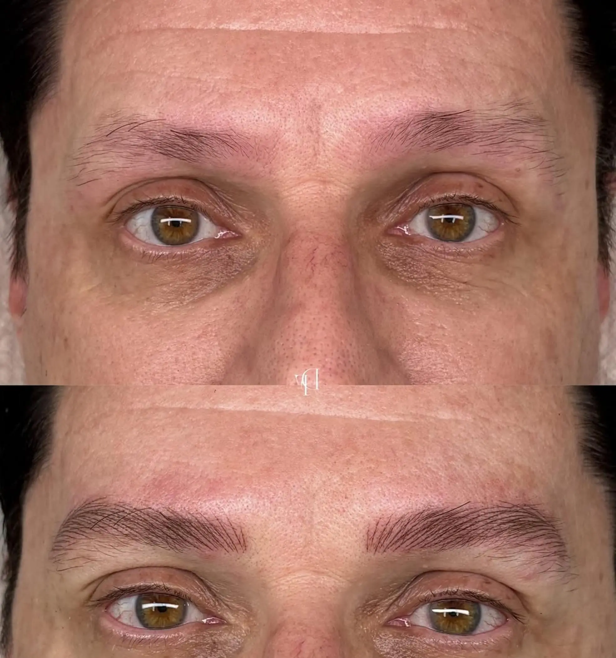 healing stages of eyebrow tattoo covered with concealer