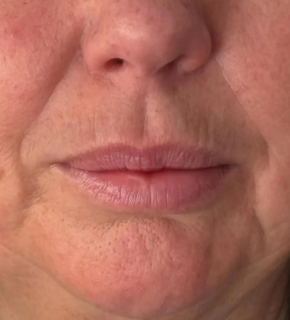 before and after lip liner tattoo olive skin